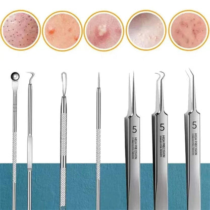 11Pcs Acne Needle Blackhead Clip Remover Extraction Pore Black Head Clean Face Skin Care Cleansing Needle Blemish Removal Tool